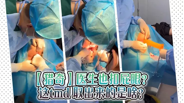 【猎奇】医生也扣屁眼? 这tmd 取出来的是啥?